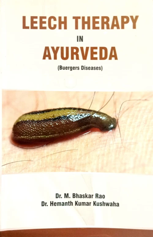 Leech Therapy in Ayurveda